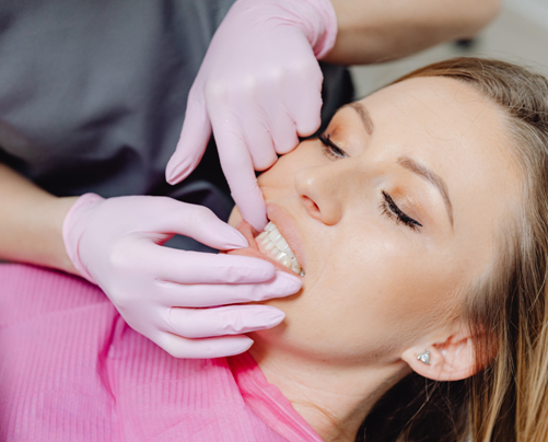 Bruxism Treatment London