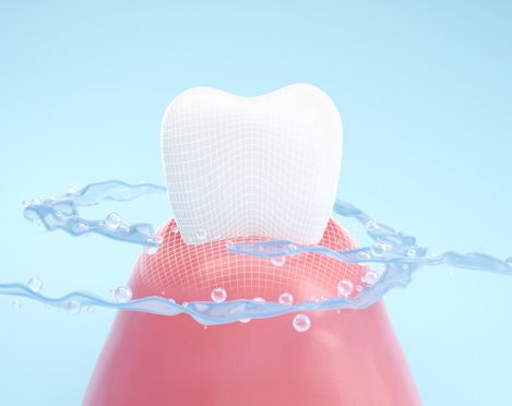 waterflosser