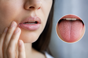 a close up of a woman touching her face with a round image next to her showing a close up of a tongue and dry mouth
