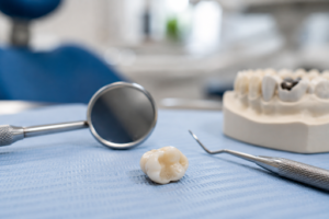dental tools including a hand mirror and a model tooth with a missing filling
